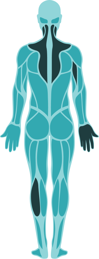 Illustration Of The Human Body With Muscle Groups Highlighted Illustration Of The Human Body With Muscle Groups Highlighted